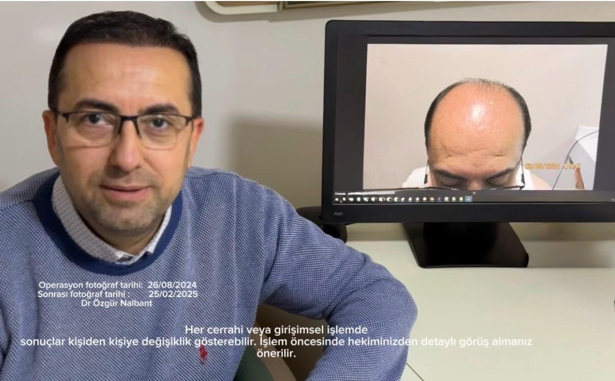 Önce - Sonra 11