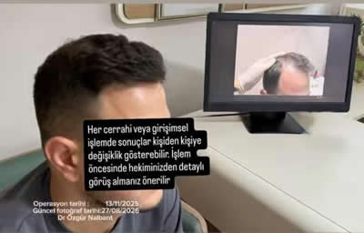 Önce - Sonra 25